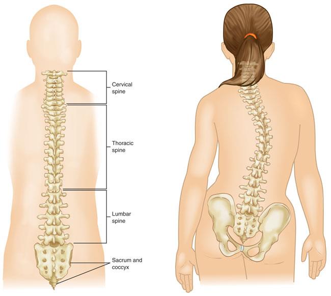 Scoliosis In Children And Adults